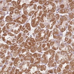 DTD2 Antibody, Novus Biologicals:Antibodies:Primary Antibodies